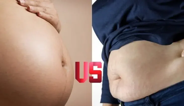 diferença entre barriga de grávida e gordura